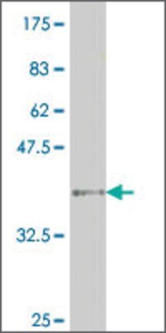 ANTI-HNF4A antibody produced in mouse