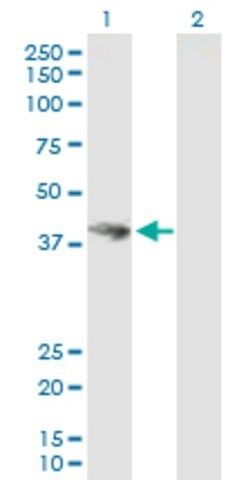 Anti-HOMER3 antibody produced in mouse