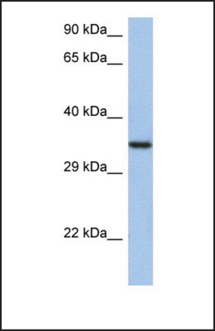Anti-HORMAD2, (N-terminal) antibody produced in rabbit