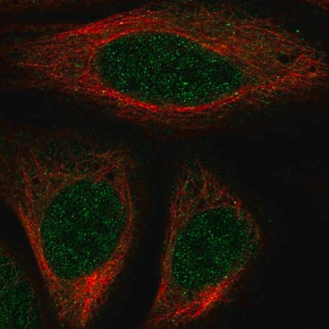 Anti-HOXA7 antibody produced in rabbit