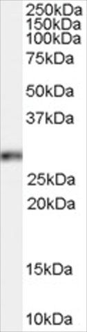 Anti-Homeobox B13 antibody produced in goat