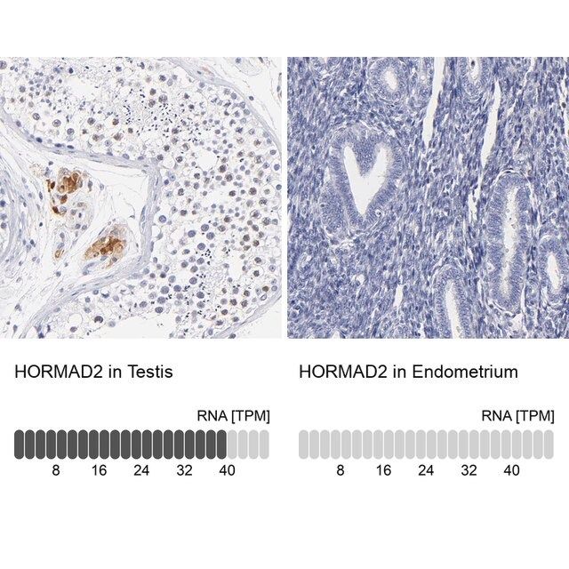 Anti-HORMAD2 antibody produced in rabbit