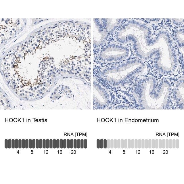 Anti-HOOK1 antibody produced in rabbit