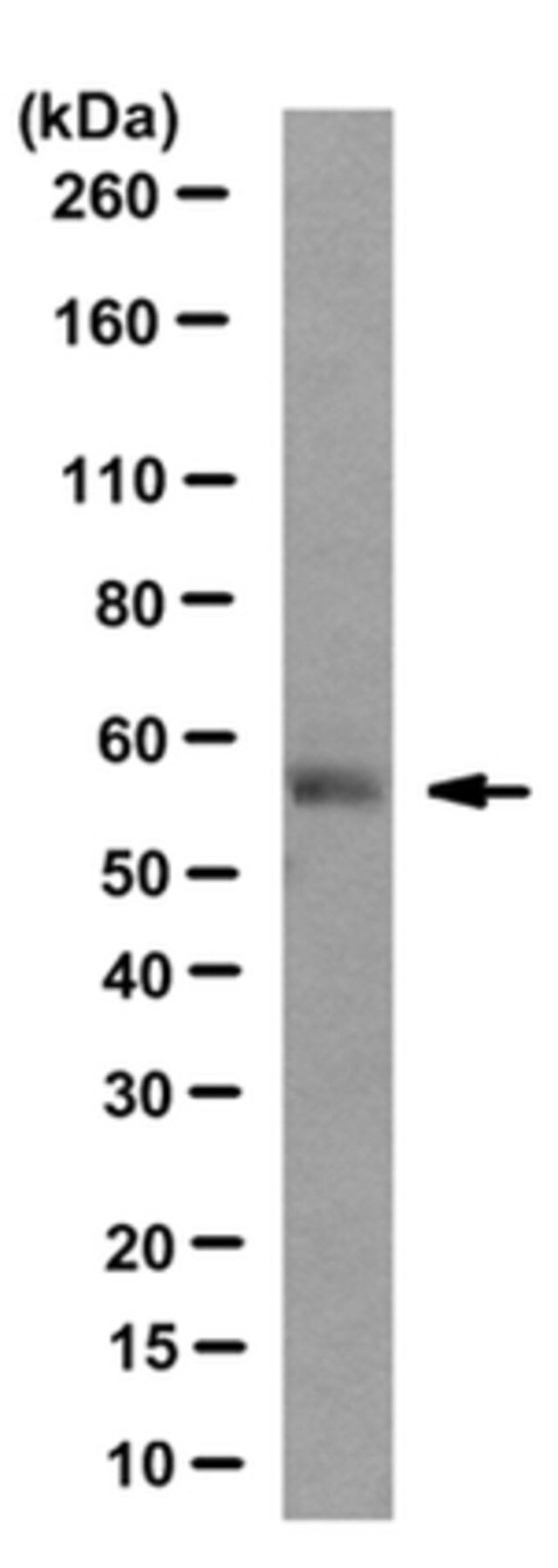 Anti-HOIL-1 Antibody, clone 2E2