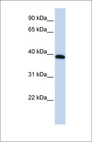 Anti-HOXA10 antibody produced in rabbit