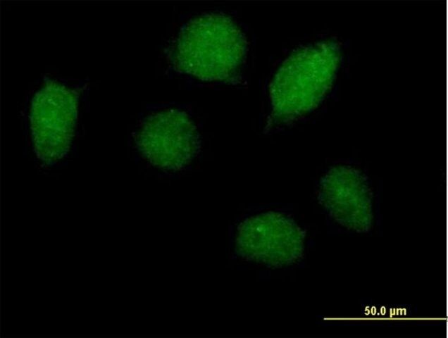 Anti-HOXA1 antibody produced in mouse