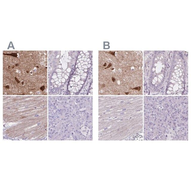 Anti-HOMER1 antibody produced in rabbit