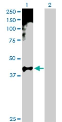 Anti-HOXA11 antibody produced in rabbit