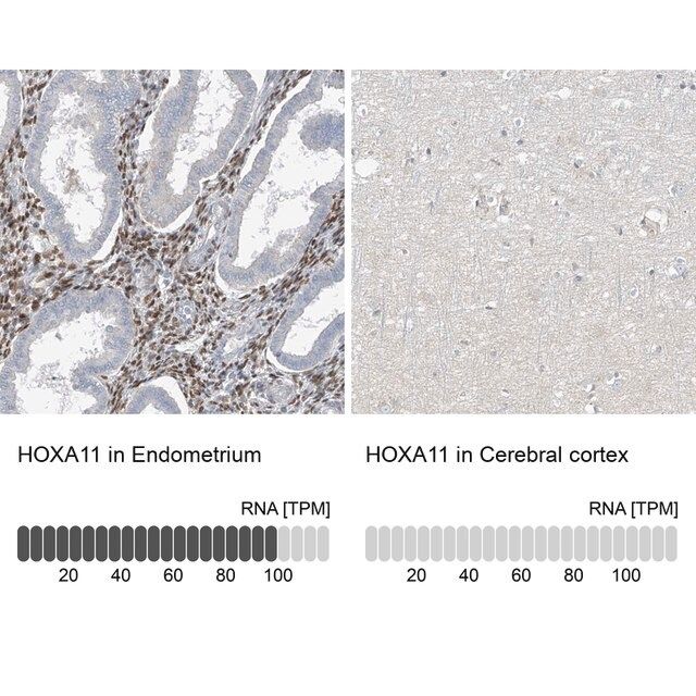 Anti-HOXA11 antibody produced in rabbit