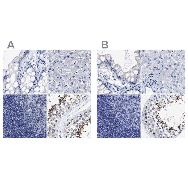 Anti-HOOK1 antibody produced in rabbit