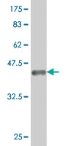 ANTI-HOXA5 antibody produced in mouse