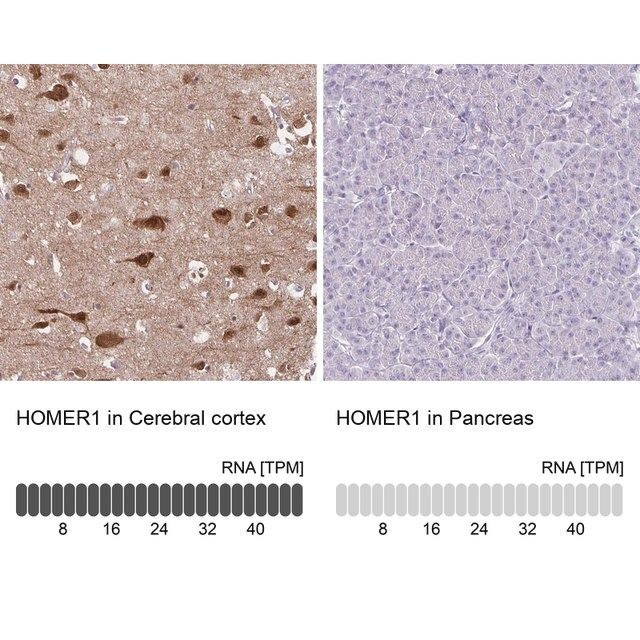 Anti-HOMER1 antibody produced in rabbit