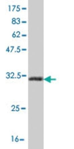 ANTI-HOXB7 antibody produced in mouse