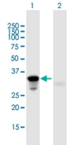 Anti-HOXA9 antibody produced in mouse