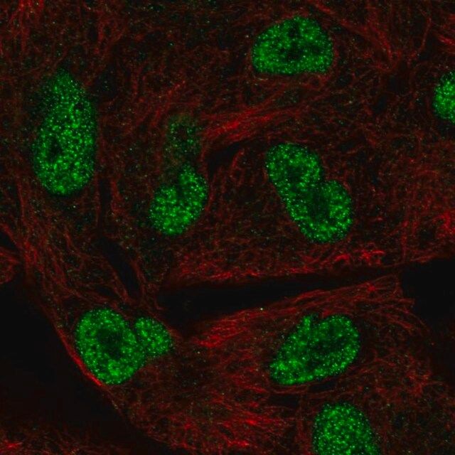 Anti-HORMAD1 antibody produced in rabbit