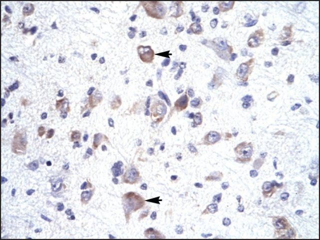Anti-HOXA1 antibody produced in rabbit