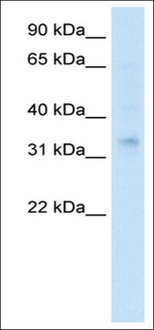 Anti-HOXA2 antibody produced in rabbit
