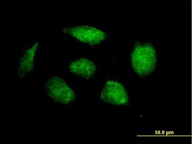 Anti-HOXB1 antibody produced in mouse
