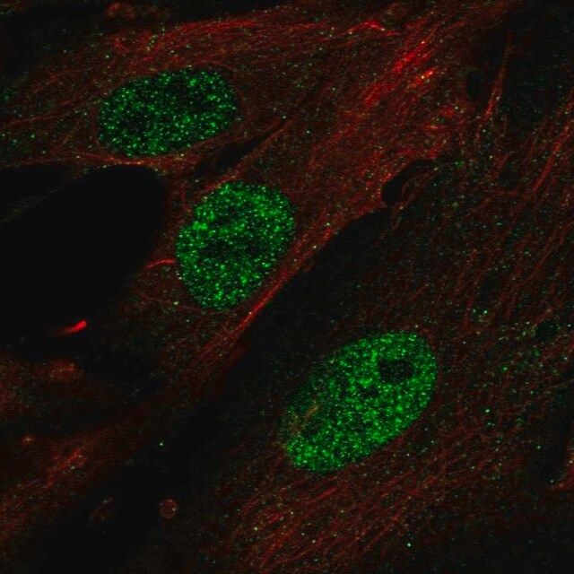 Anti-HOXA11 antibody produced in rabbit