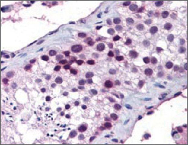 Anti-HOXA5 antibody produced in rabbit