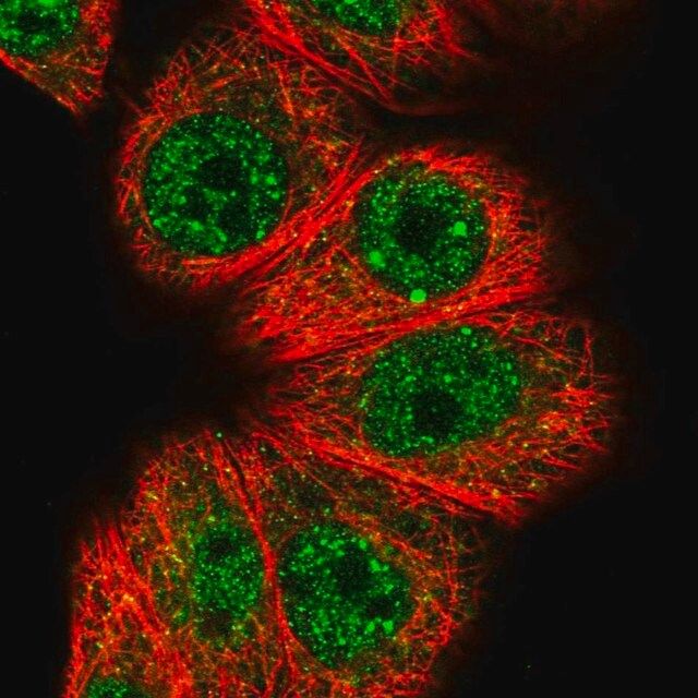 Anti-HOXB7 antibody produced in rabbit