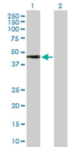 Anti-HOXA1 antibody produced in rabbit