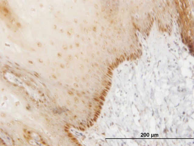 ANTI-HOXB7 antibody produced in mouse