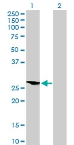 Anti-HOXB9 antibody produced in mouse