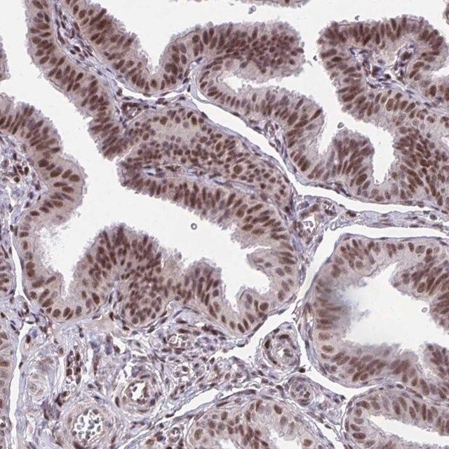 Anti-HOXA4 antibody produced in rabbit