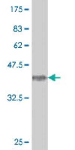ANTI-HOXA5 antibody produced in mouse
