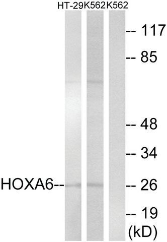 Anti-HOXA6 antibody produced in rabbit