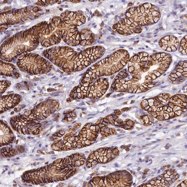 Anti-HPS6 antibody produced in rabbit