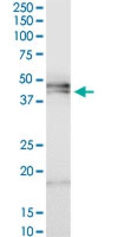 ANTI-HPR antibody produced in mouse
