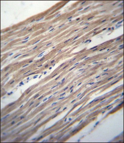 ANTI-HRC (CENTER) antibody produced in rabbit