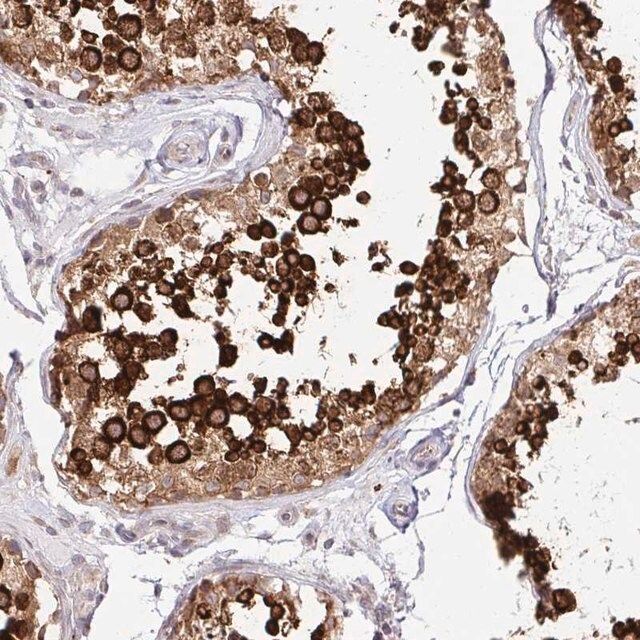 Anti-HPS1 antibody produced in rabbit