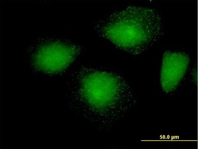 Anti-HIP1R antibody produced in mouse