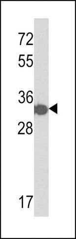 ANTI-HIS TAG antibody produced in rabbit