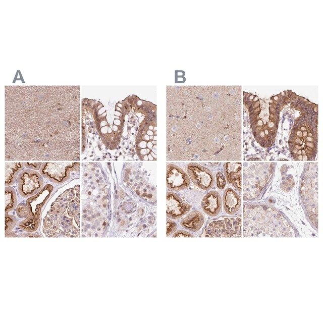 Anti-HIP1R antibody produced in rabbit