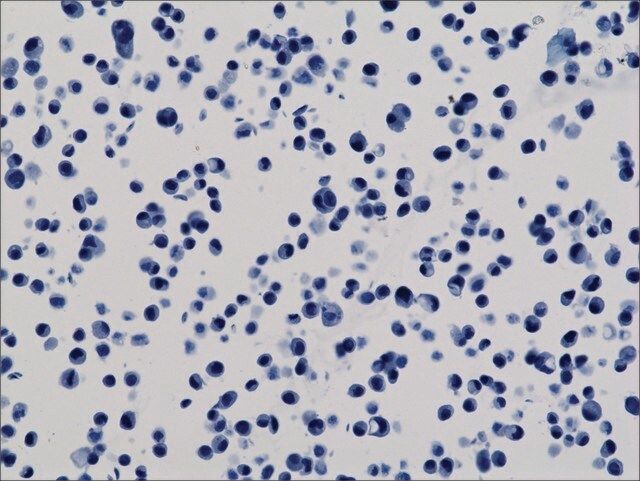 Anti-His-Tag antibody, Rabbit monoclonal