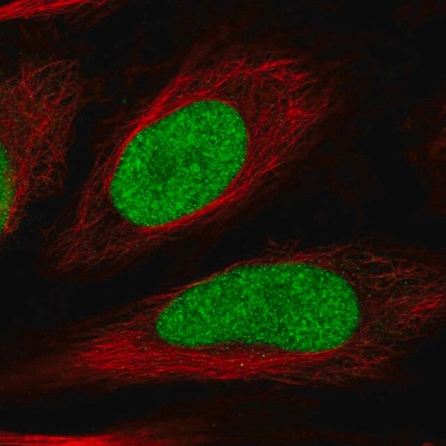 Anti-HIRIP3 antibody produced in rabbit