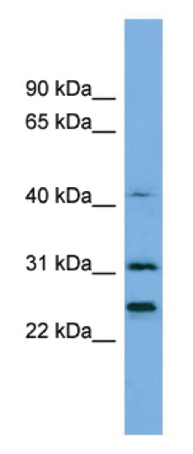 Anti-HIST1H1E (N-terminal) antibody produced in rabbit