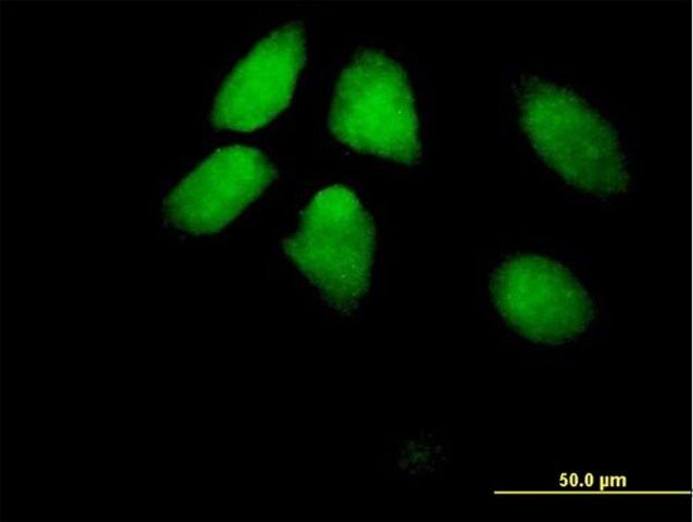 Anti-HIRA antibody produced in mouse