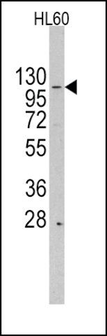 Anti-HIRA (center) antibody produced in rabbit