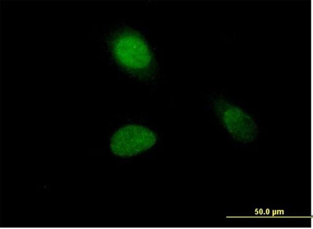 Anti-HIST1H1A antibody produced in mouse