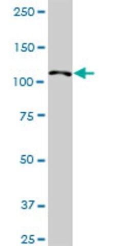 Anti-HIP1R antibody produced in rabbit