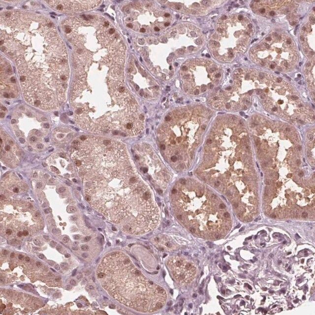 Anti-HIRIP3 antibody produced in rabbit