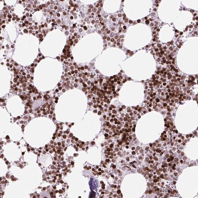 Anti-HIST1H1C antibody produced in rabbit