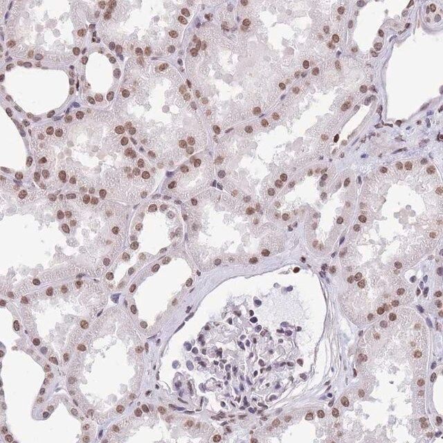 Anti-HIST1H2BC antibody produced in rabbit