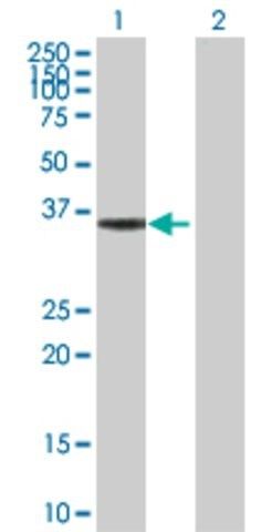 Anti-HMGCL antibody produced in rabbit