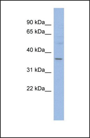 Anti-HMGCLL1, (N-terminal) antibody produced in rabbit